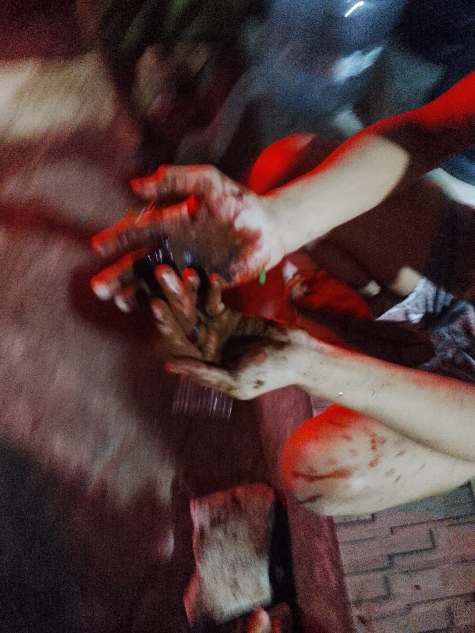 Rumah Dibobol, Anak Pemilik Rumah Dibacok Perampok Bersenjata Tajam